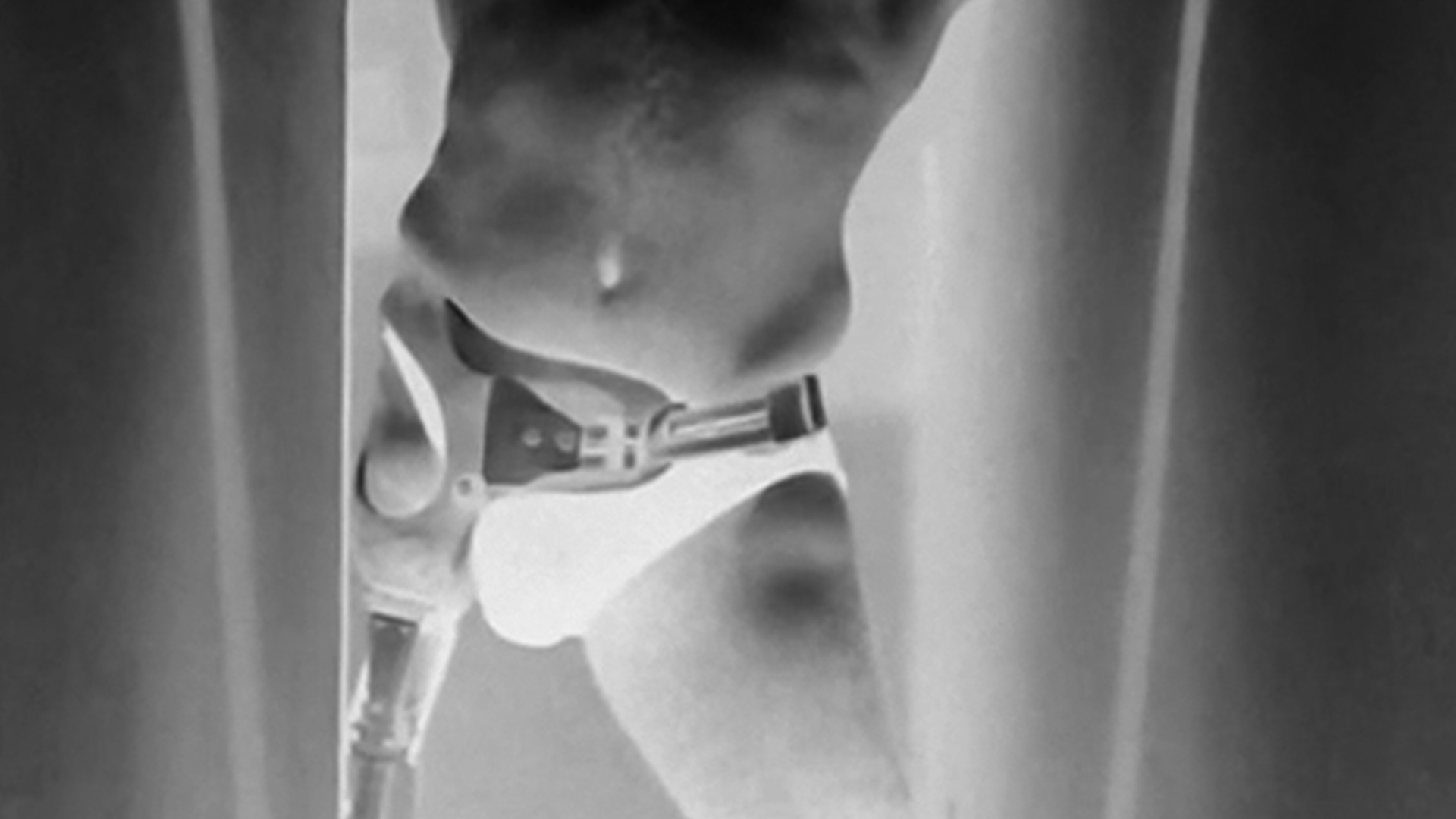 Devotees - João Paulo Lima